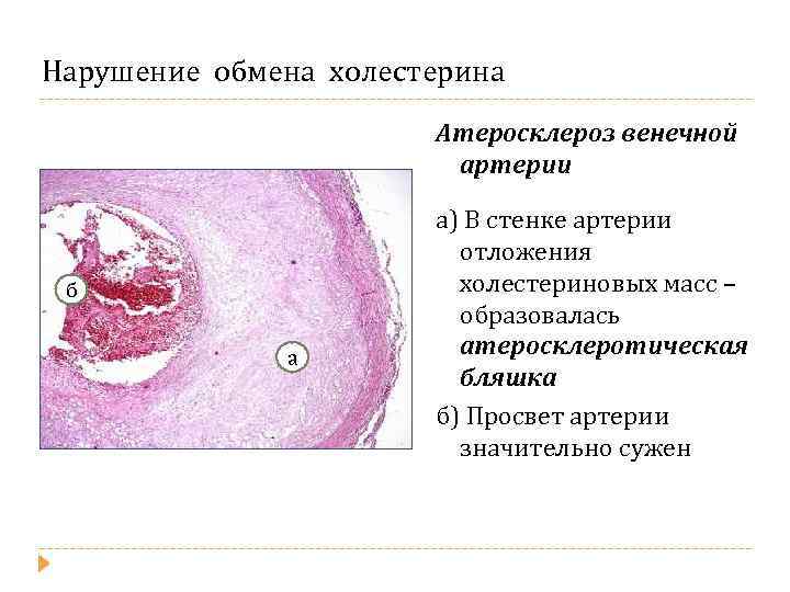 Острый холецистопанкреатит карта вызова