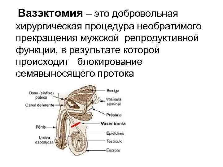 Вазэктомия – это добровольная хирургическая процедура необратимого прекращения мужской репродуктивной функции, в результате которой