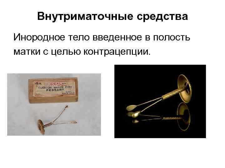 Внутриматочные средства Инородное тело введенное в полость матки с целью контрацепции. 