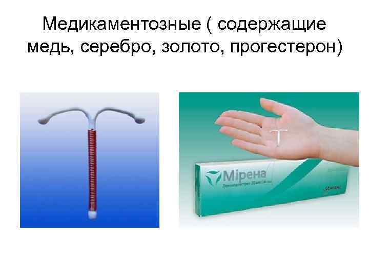 Медикаментозные ( содержащие медь, серебро, золото, прогестерон) 