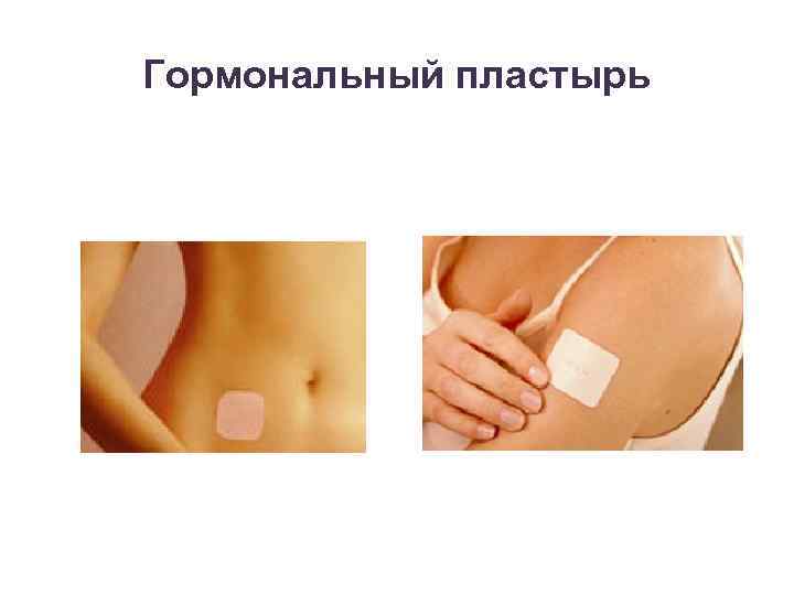 Гормональный пластырь 
