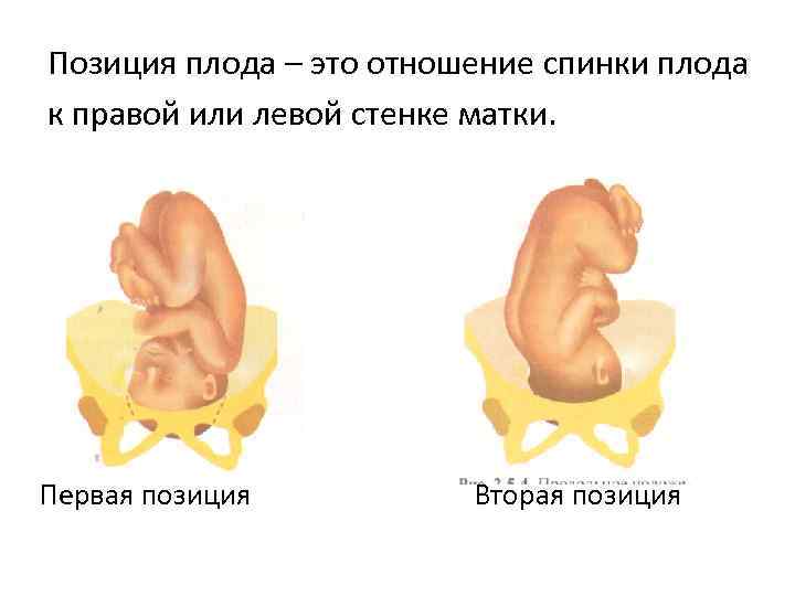 Позиция плода – это отношение спинки плода к правой или левой стенке матки. Первая