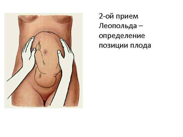 2 -ой прием Леопольда – определение позиции плода 