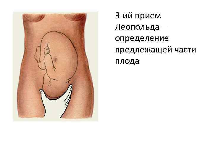 3 -ий прием Леопольда – определение предлежащей части плода 