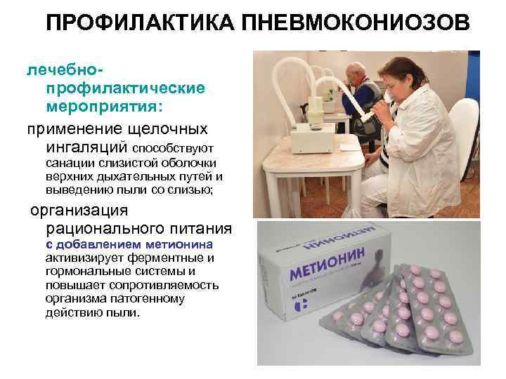 ПРОФИЛАКТИКА ПНЕВМОКОНИОЗОВ лечебнопрофилактические мероприятия: применение щелочных ингаляций способствуют санации слизистой оболочки верхних дыхательных путей