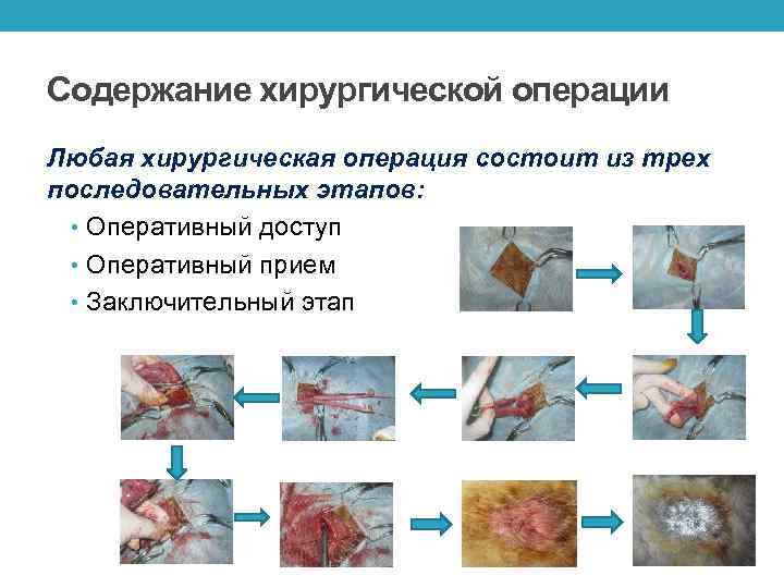 Содержание хирургической операции Любая хирургическая операция состоит из трех последовательных этапов: • Оперативный доступ