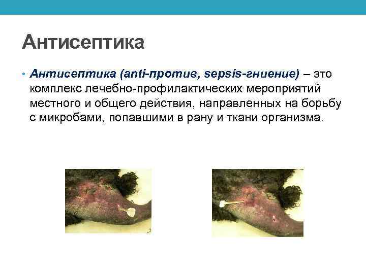 Антисептика • Антисептика (anti-против, sepsis-гниение) – это комплекс лечебно-профилактических мероприятий местного и общего действия,