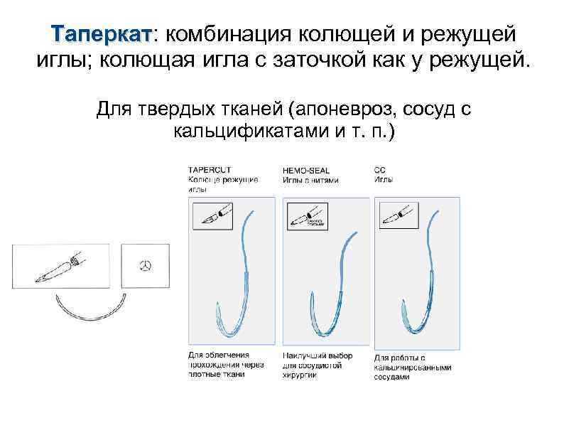 Таперкат: комбинация колющей и режущей Таперкат иглы; колющая игла с заточкой как у режущей.