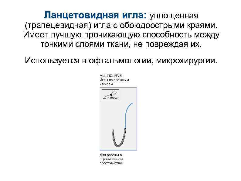 Ланцетовидная игла: уплощенная (трапецевидная) игла с обоюдоострыми краями. Имеет лучшую проникающую способность между тонкими