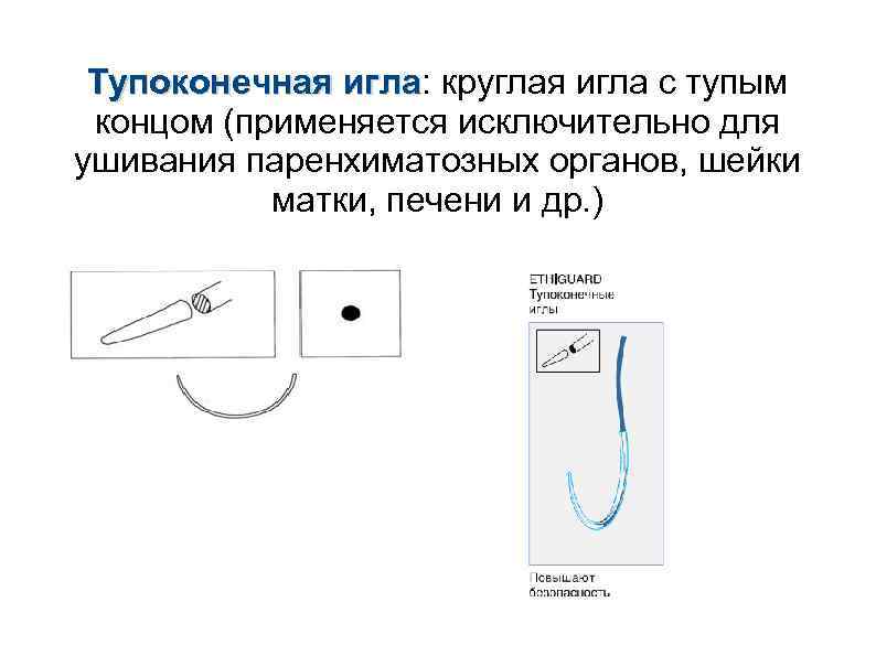 Тупоконечная игла: круглая игла с тупым игла концом (применяется исключительно для ушивания паренхиматозных органов,