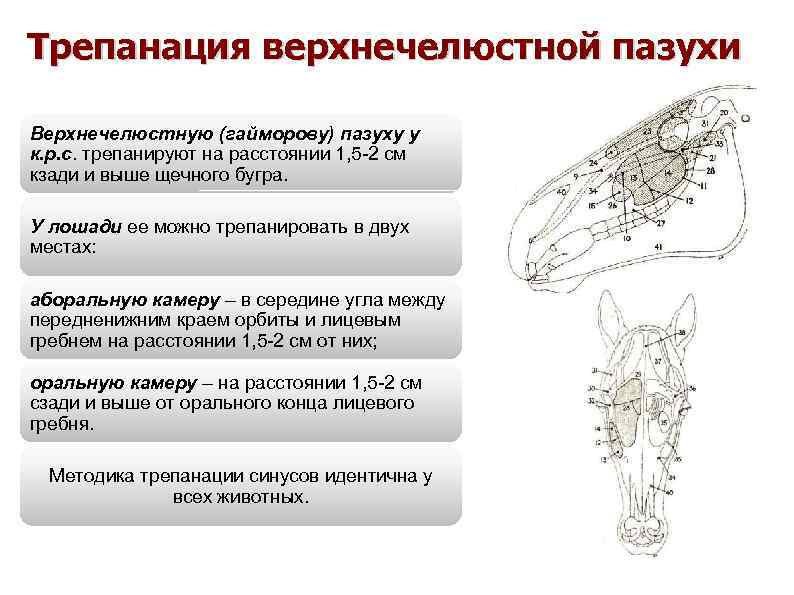 Рак верхнечелюстной пазухи презентация