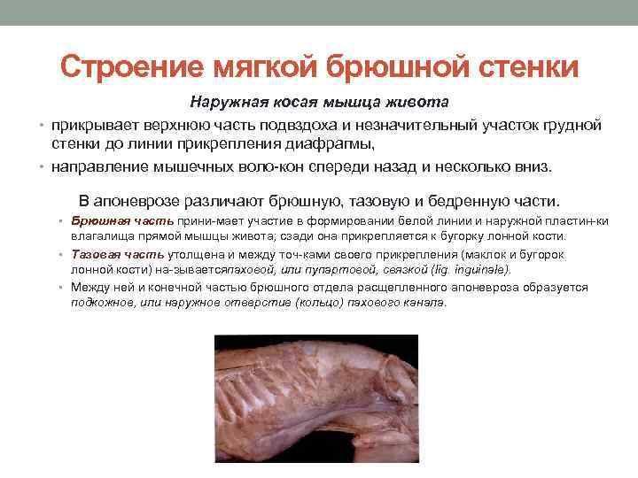 Строение мягкой брюшной стенки Наружная косая мышца живота • прикрывает верхнюю часть подвздоха и