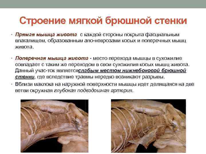 Строение мягкой брюшной стенки • Прямая мышца живота с каждой стороны покрыта фасциальным влагалищем,