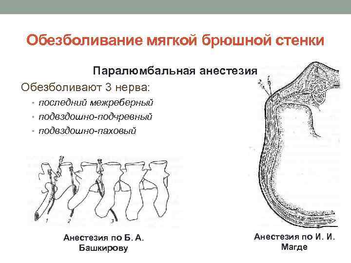 Обезболивание мягкой брюшной стенки Паралюмбальная анестезия Обезболивают 3 нерва: • последний межреберный • подвздошно