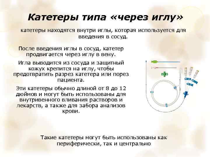 Катетеры типа «через иглу» катетеры находятся внутри иглы, которая используется для введения в сосуд.
