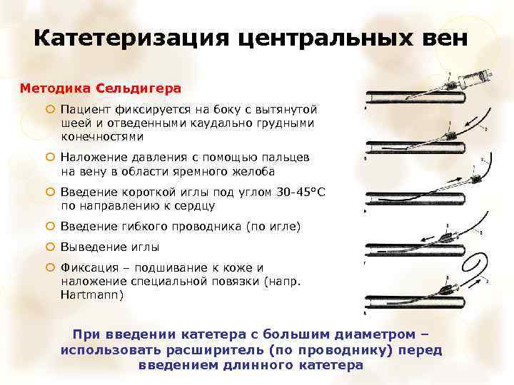 Катетеризация центральных вен Методика Сельдигера Пациент фиксируется на боку с вытянутой шеей и отведенными