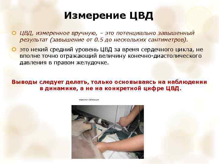 Измерение ЦВД, измеренное вручную, – это потенциально завышенный результат (завышение от 0. 5 до