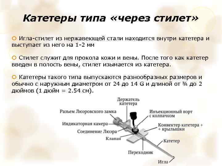 Катетеры типа «через стилет» Игла-стилет из нержавеющей стали находится внутри катетера и выступает из