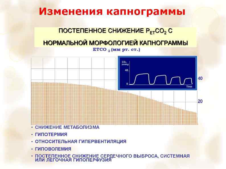 Изменения капнограммы 