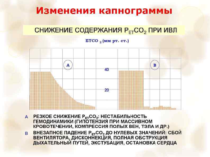 Изменения капнограммы 
