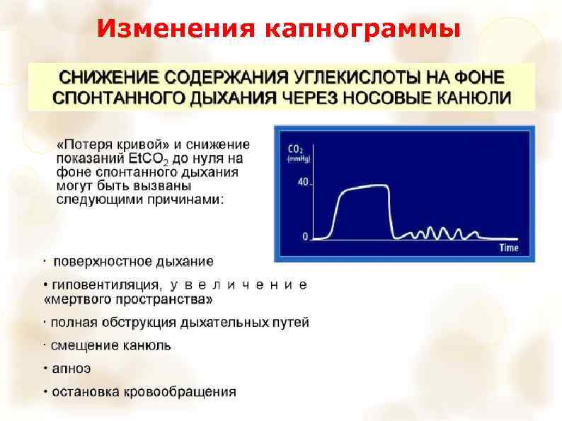 Изменения капнограммы 