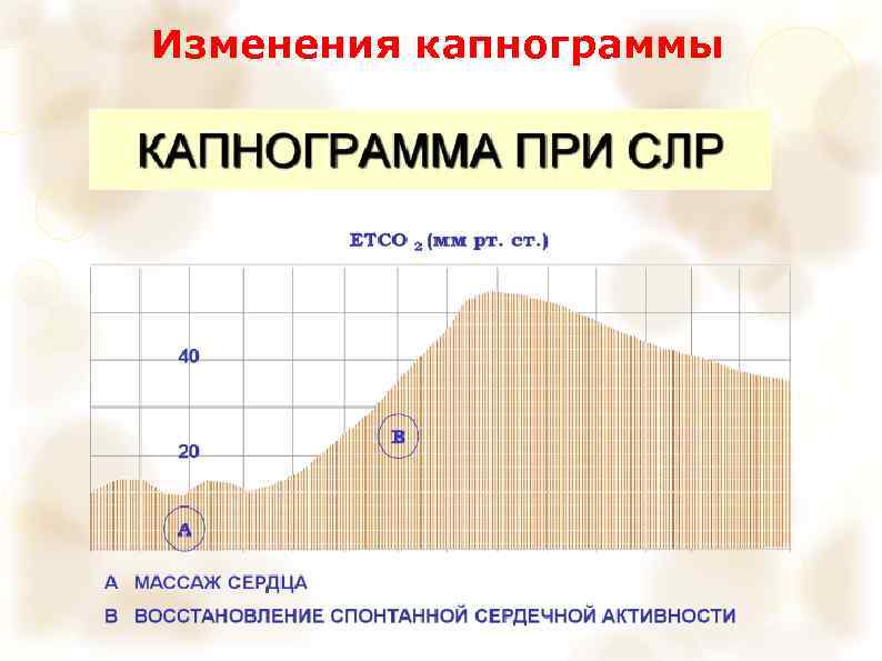 Изменения капнограммы 