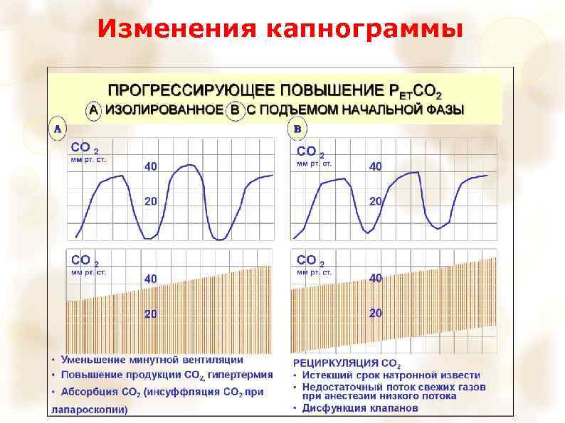 Изменения капнограммы 