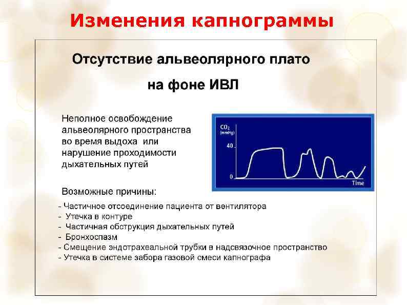 Изменения капнограммы 