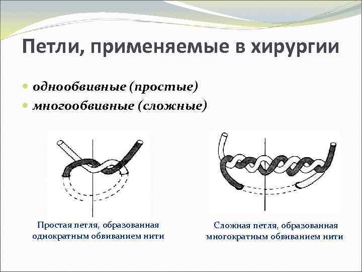 Петли, применяемые в хирургии однообвивные (простые) многообвивные (сложные) Простая петля, образованная однократным обвиванием нити