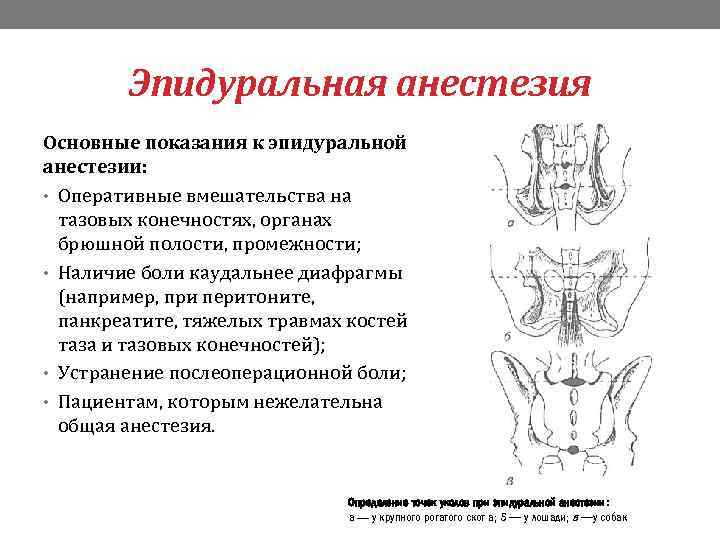 Эпидуральная анестезия Основные показания к эпидуральной анестезии: • Оперативные вмешательства на тазовых конечностях, органах