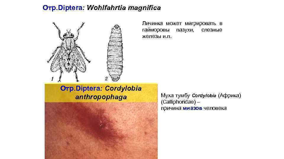 Отр. Diptera: Wohlfahrtia magnifica Личинка может мигрировать в гайморовы пазухи, слезные железы и. п.