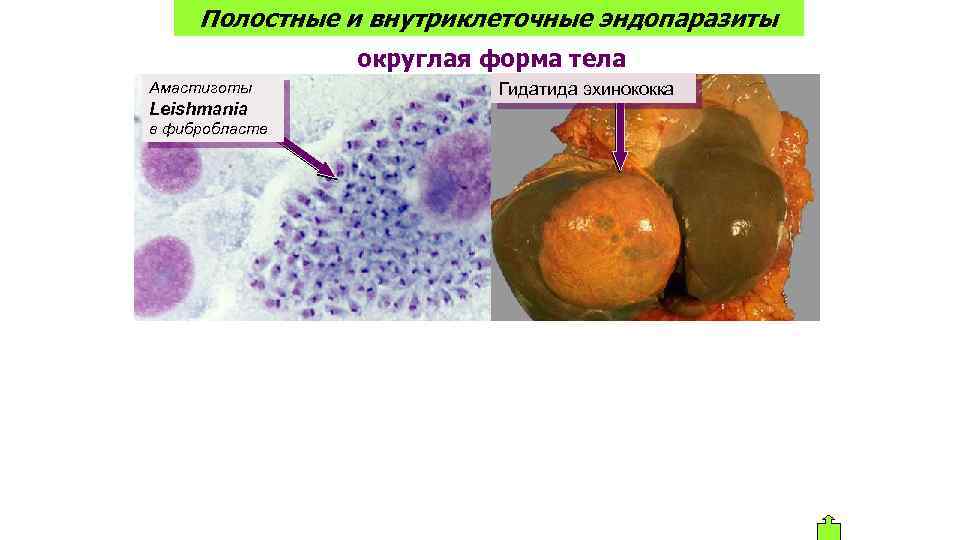 Полостные и внутриклеточные эндопаразиты округлая форма тела Гидатида эхинококка Амастиготы Leishmania в фибробласте (цистицерк