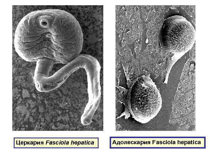 Церкария Fasciola hepatica Адолескария Fasciola hepatica 