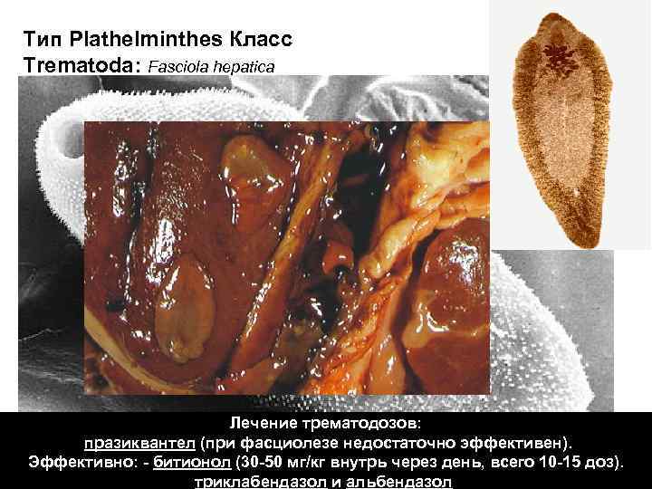 Тип Plathelminthes Класс Trematoda: Fasciola hepatica Лечение трематодозов: празиквантел (при фасциолезе недостаточно эффективен). Эффективно: