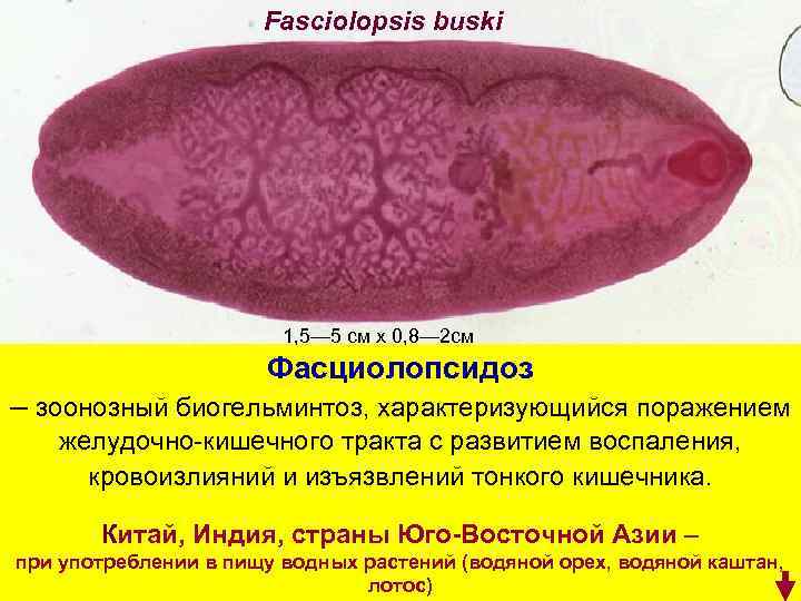 Fasciolopsis buski 1, 5— 5 см х 0, 8— 2 см Фасциолопсидоз – зоонозный