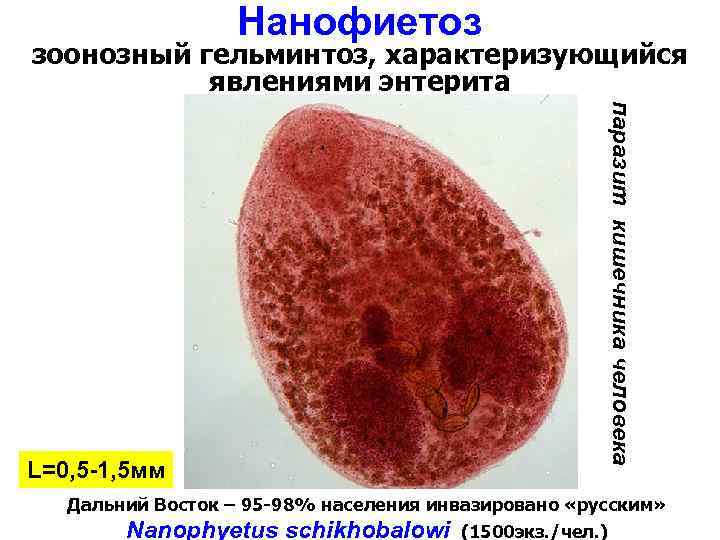 Нанофиетоз зоонозный гельминтоз, характеризующийся явлениями энтерита паразит кишечника человека L=0, 5 -1, 5 мм