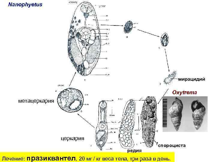 Спороциста редия. Мирацидий спороциста редия церкарий. Жизненный цикл нанофиетуса. Жизненный цикл нанофиетоза. Nanophyetus Salmincola schikhobalowi жизненный цикл.