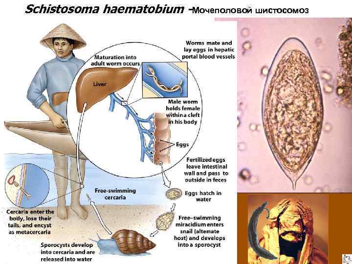 Путь заражения шистосомозом