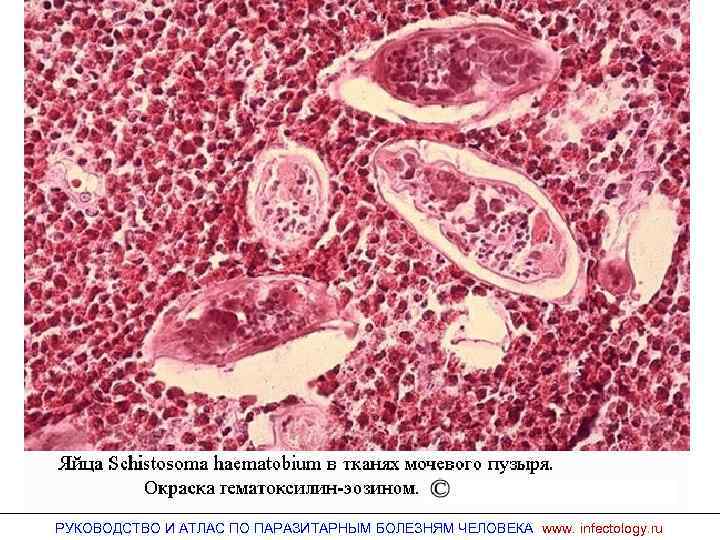 РУКОВОДСТВО И АТЛАС ПО ПАРАЗИТАРНЫМ БОЛЕЗНЯМ ЧЕЛОВЕКА www. infectology. ru 