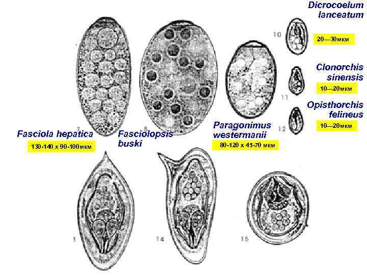 Dicrocoelum lanceatum 20— 30 мкм Clonorchis sinensis 10— 20 мкм Fasciola hepatica 130 -140