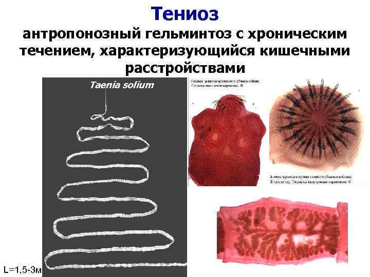 Тениоз антропонозный гельминтоз с хроническим течением, характеризующийся кишечными расстройствами Taenia solium L=1, 5 -3