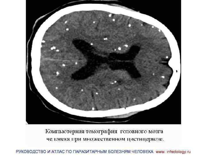 РУКОВОДСТВО И АТЛАС ПО ПАРАЗИТАРНЫМ БОЛЕЗНЯМ ЧЕЛОВЕКА www. infectology. ru 