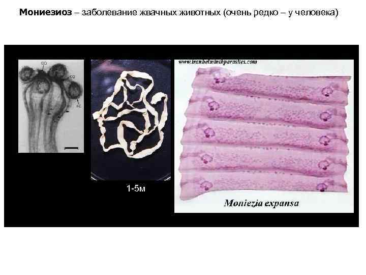 Мониезиоз – заболевание жвачных животных (очень редко – у человека) 1 -5 м 