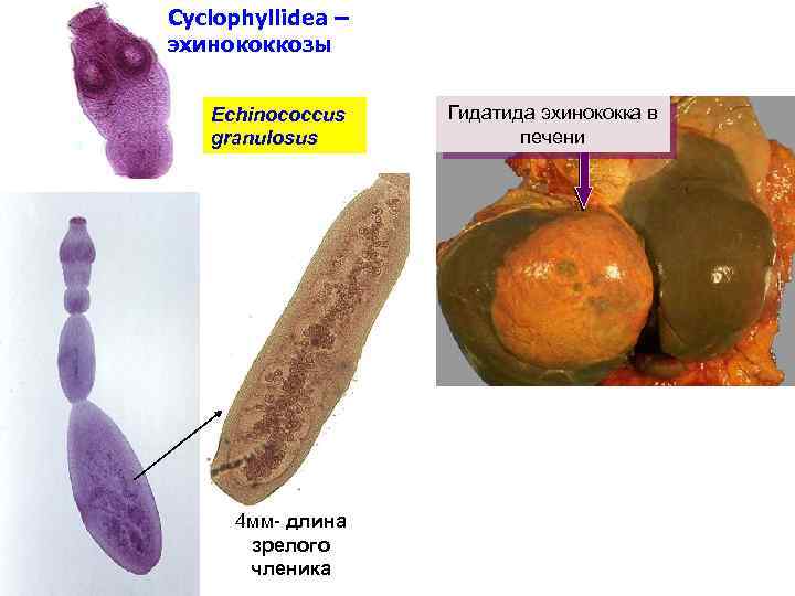 Cyclophyllidea – эхинококкозы Echinococcus granulosus 4 мм- длина зрелого членика Гидатида эхинококка в печени