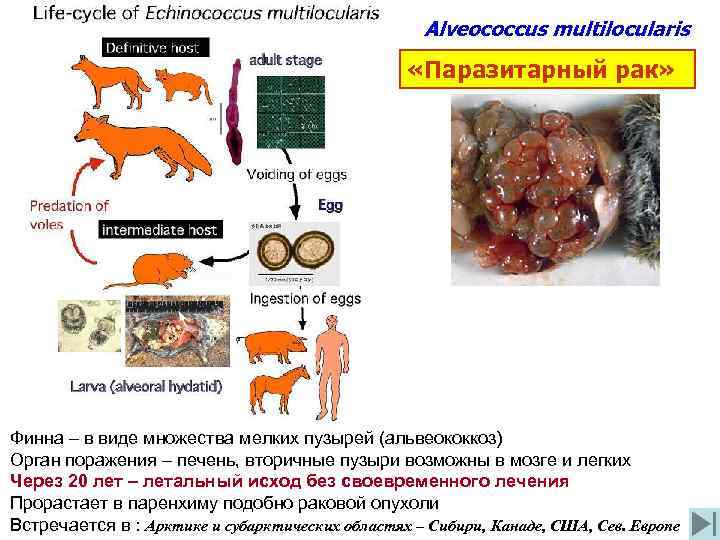 Alveococcus multilocularis «Паразитарный рак» Финна – в виде множества мелких пузырей (альвеококкоз) Орган поражения