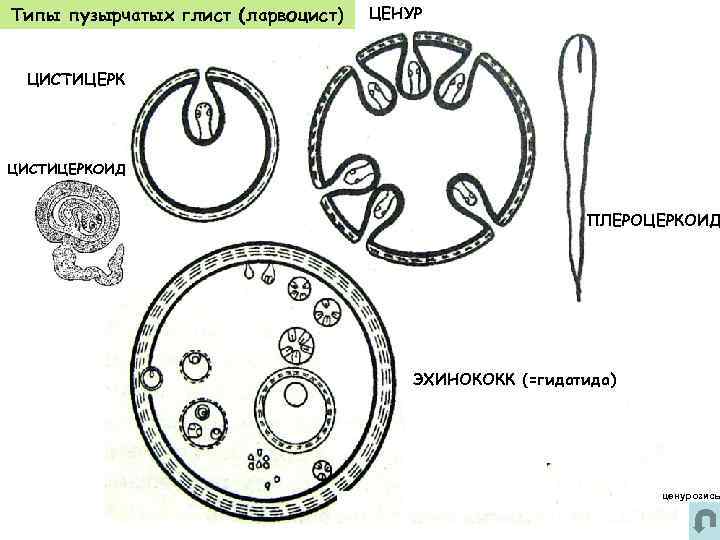 Типы пузырчатых глист (ларвоцист) ЦИСТИЦЕРК ЦЕНУР ПЛЕРОЦЕРКОИД ЦИСТИЦЕРКОИД ПЛЕРОЦЕРКОИД ЭХИНОКОКК (=гидатида) ценурозисы 