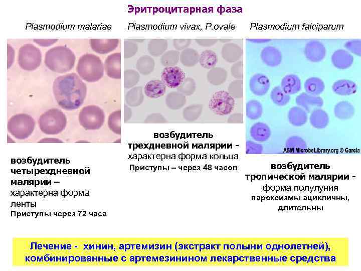 Эритроцитарная фаза Plasmodium malariae возбудитель четырехдневной малярии – характерна форма ленты Приступы через 72