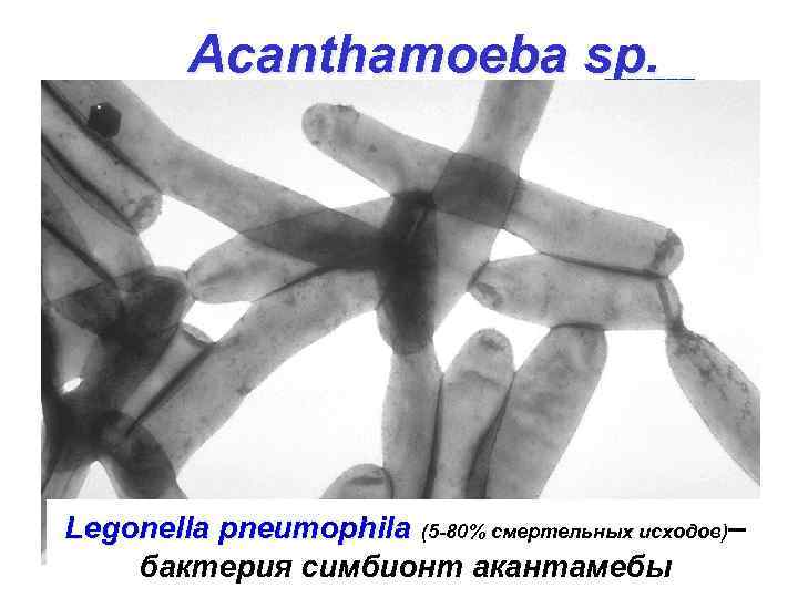 Acanthamoeba sp. Acanthamoeba keratitis Legonella pneumophila (5 -80% смертельных исходов)– бактерия симбионт акантамебы 