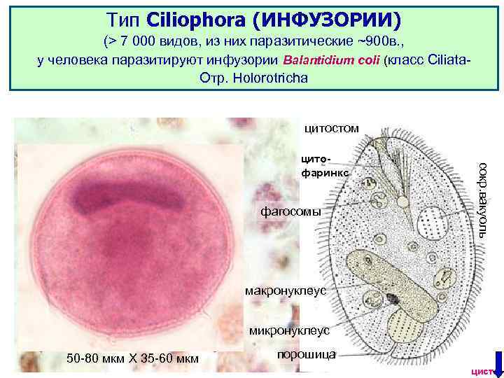 Тип Ciliophora (ИНФУЗОРИИ) (> 7 000 видов, из них паразитические ~900 в. , у