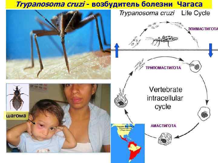 Trypanosoma cruzi - возбудитель болезни Чагаса ЭПИМАСТИГОТА ТРИПОМАСТИГОТА шагома АМАСТИГОТА 